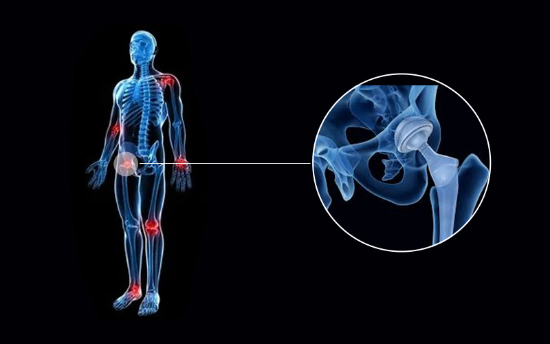 biocompatible material in orthopedics